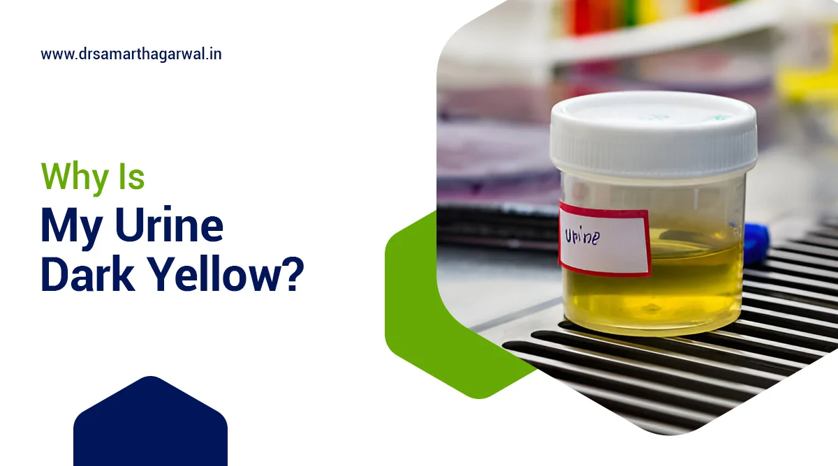 Why Is My Urine Dark Yellow?