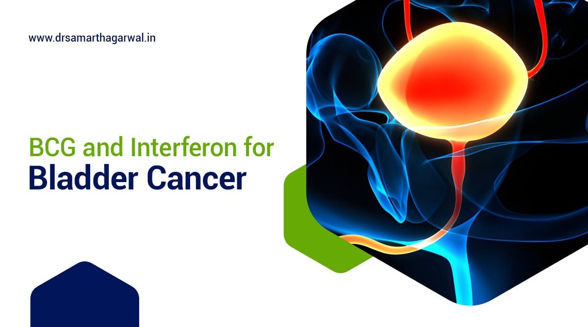 BCG and Interferon for Bladder Cancer