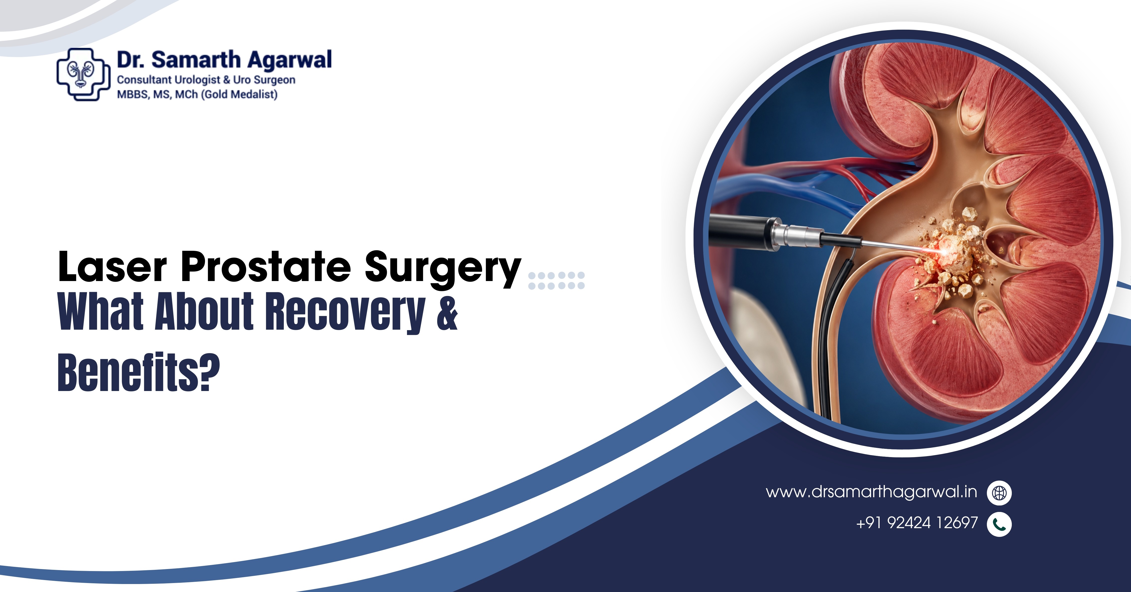 Laser Prostate Surgery: What About Recovery & Benefits?