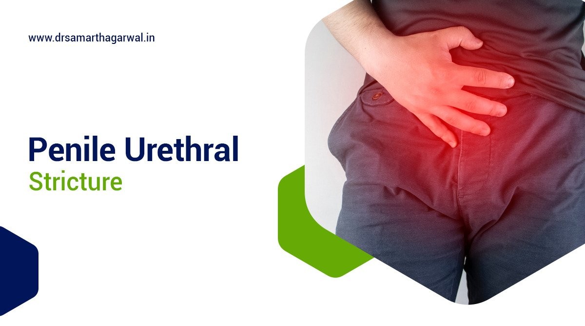 Penile Urethral Stricture - Causes, Coping Strategies