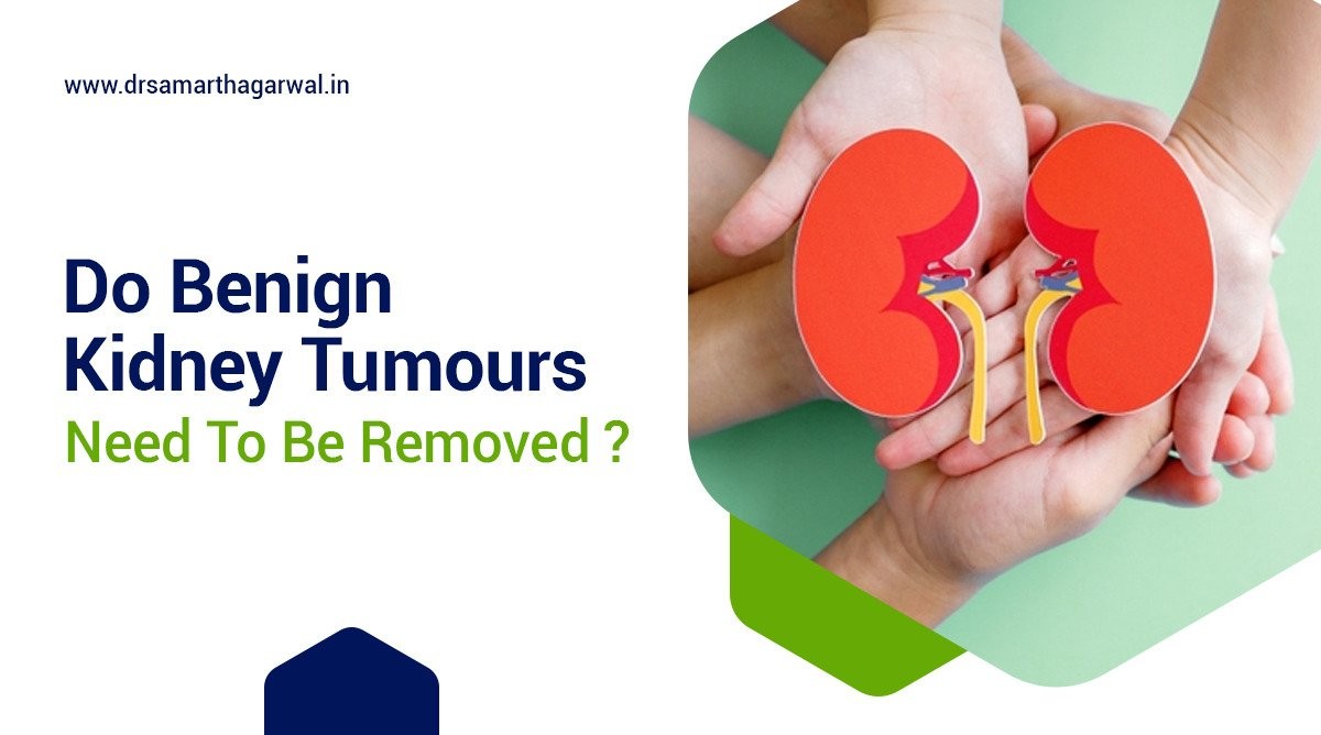 Do benign kidney tumors need to be removed?