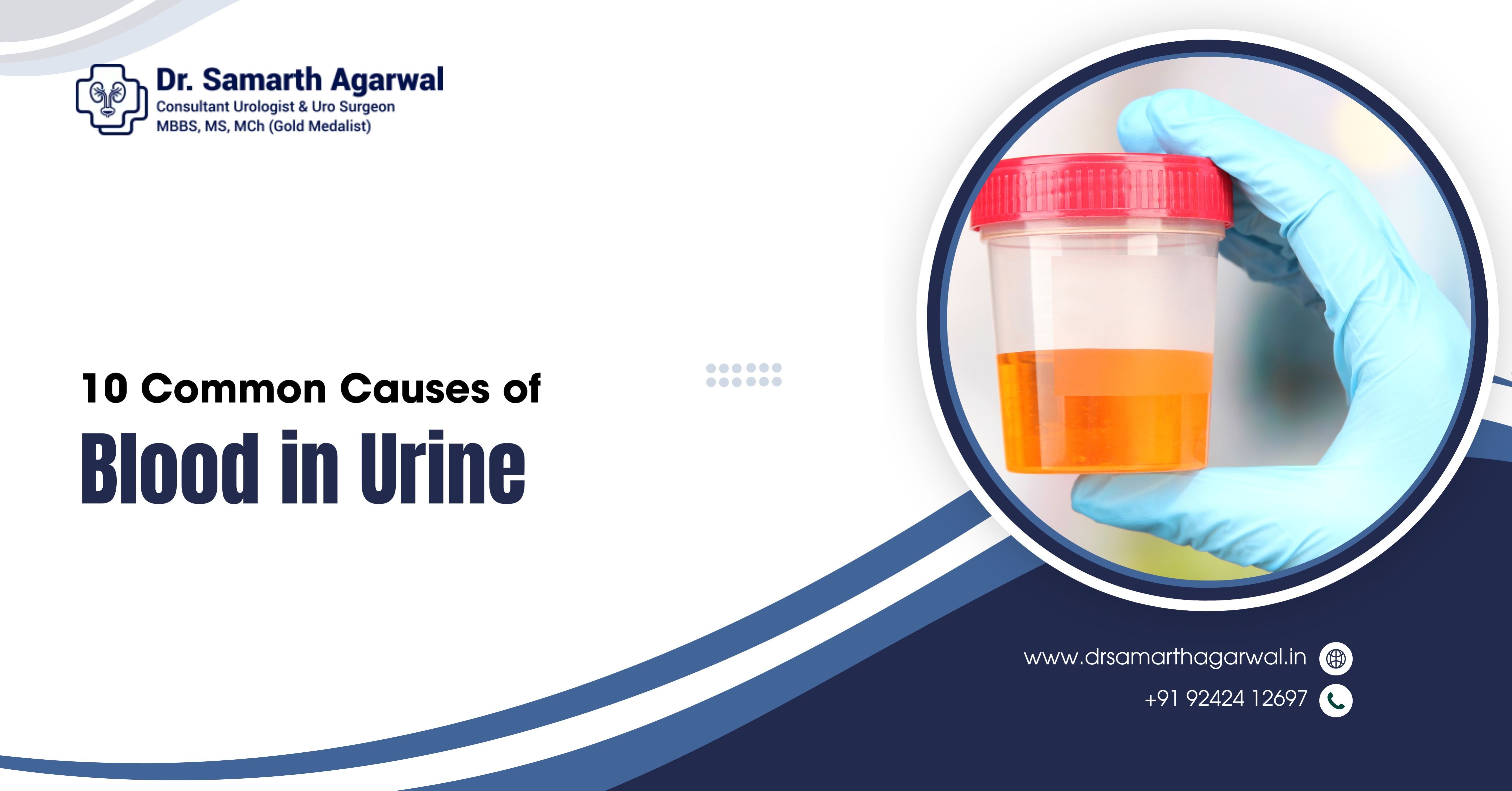 10 Common Causes of Blood in Urine