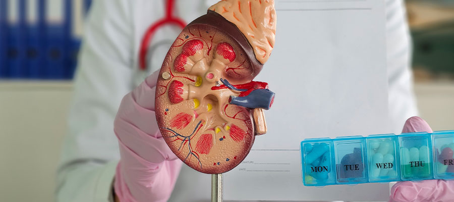 Best Kidney Stone Specialist in Siliguri