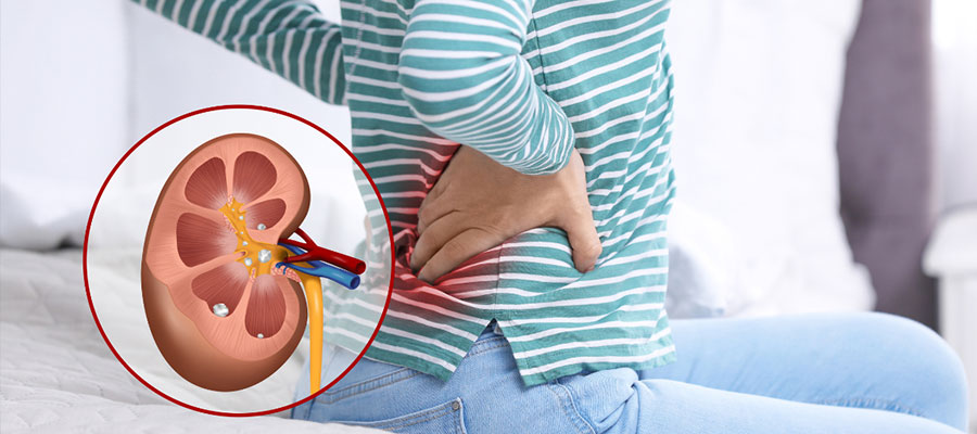 Kidney Stone Treatment in Sliguri