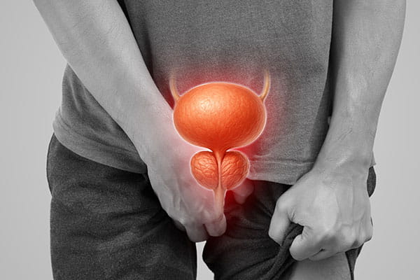 Enlarged Prostate