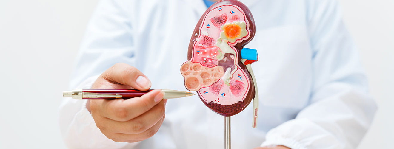 Kidney Cancer